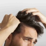 وسواس موکنی | تشخیص و نحوه درمان وسواس کندن مو