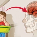 بررسی مغز کودکان با نقص توجه و بیش فعالی￼